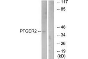 Western blot analysis of extracts from HeLa cells, using PTGER2 Antibody.