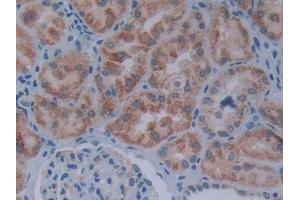 DAB staining on IHC-P; Samples: Human Kidney Tissue (SIVA1 antibody  (AA 1-175))