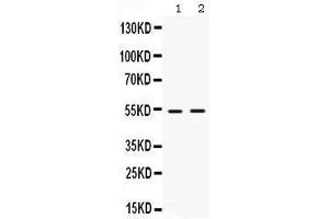 Observed bind size: 53KD (HSF4 antibody  (N-Term))