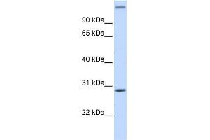 WB Suggested Anti-ALKBH2 Antibody Titration: 0. (ALKBH2 antibody  (Middle Region))