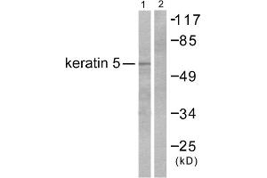 Western blot analysis of extracts from HepG2 cells, using Keratin 5 antibody (ABIN5976441). (Cytokeratin 5 antibody  (C-Term))