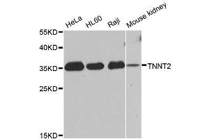 Western blot analysis of extracts of various cell lines, using TNNT2 antibody. (Cardiac Troponin T2 antibody  (AA 1-120))