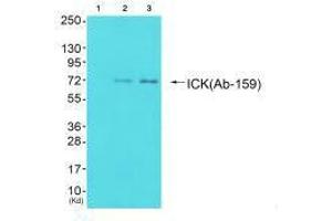 Western blot analysis of extracts from 293 cells (Lane 2) and cos-7 cells (Lane 3), using ICK (Ab-159) antiobdy. (ICK antibody  (Tyr159))