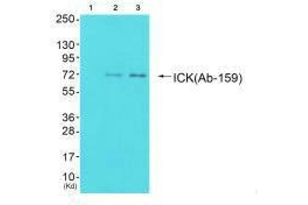 ICK antibody  (Tyr159)