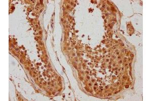 IHC image of ABIN7175810 diluted at 1:500 and staining in paraffin-embedded human testis tissue performed on a Leica BondTM system. (WDR92 antibody  (AA 122-357))