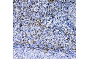 IHC analysis of CD7 using anti-CD7 antibody . (CD7 antibody  (AA 26-172))