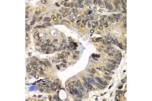 Immunohistochemistry of paraffin-embedded human colon using UFD1L antibody (ABIN6291036) at dilution of 1:100 (40x lens). (UFD1L antibody)
