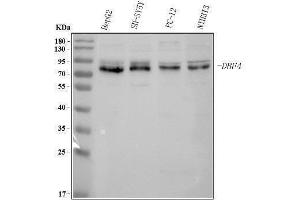 Western blot analysis of DBF4 using anti-DBF4 antibody (ABIN7601162).