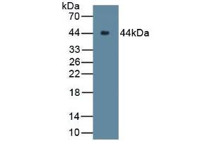 Detection of Recombinant C9, Rabbit using Polyclonal Antibody to Complement Component 9 (C9) (C9 antibody  (AA 139-519))