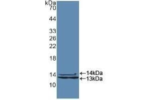 Detection of Recombinant HNRPA2B1, Human using Polyclonal Antibody to Heterogeneous Nuclear Ribonucleoprotein A2/B1 (HNRPA2B1) (HNRNPA2B1 antibody  (AA 21-103))