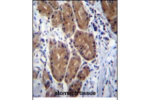 Immunohistochemistry (Paraffin-embedded Sections) (IHC (p)) image for anti-Zinc Finger CCHC-Type and RNA Binding Motif 1 (ZCRB1) (AA 184-212), (C-Term) antibody (ABIN656856)