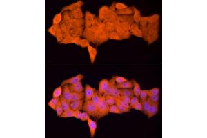 Immunofluorescence analysis of HeLa cells using PSMC5 Rabbit mAb (ABIN7269585) at dilution of 1:50 (40x lens).