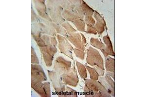 ACOT11 Antibody (C-term) immunohistochemistry analysis in formalin fixed and paraffin embedded human skeletal muscle followed by peroxidase conjugation of the secondary antibody and DAB staining. (ACOT11 antibody  (C-Term))