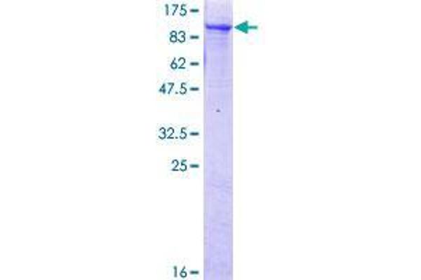 RINT1 Protein (AA 1-792) (GST tag)