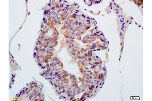 Formalin-fixed and paraffin embedded rat testis labeled with Anti-TXNRD1 Polyclonal Antibody, Unconjugated (ABIN1386102) at 1:200 followed by conjugation to the secondary antibody and DAB staining (TXNRD1 antibody  (AA 451-550))