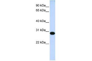 Western Blot showing DRGX antibody used at a concentration of 1-2 ug/ml to detect its target protein. (DRGX antibody  (Middle Region))