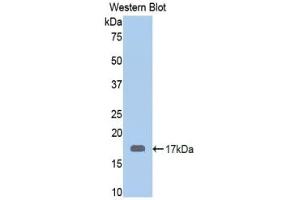 Detection of Recombinant CALR, Human using Polyclonal Antibody to Calreticulin (CALR) (Calreticulin antibody  (AA 196-310))