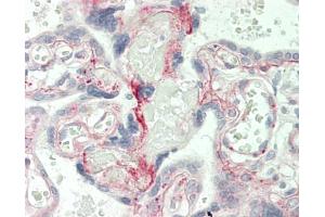 Human Placenta: Formalin-Fixed, Paraffin-Embedded (FFPE) (Laminin gamma 1 antibody)