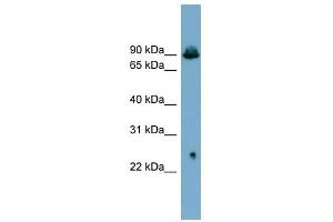 SLC6A5 antibody used at 1 ug/ml to detect target protein.