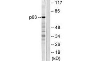 Western blot analysis of extracts from COS7 cells, using p63 Antibody.