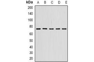 Western blot analysis of STS-1 expression in SW620 (A), SKOV3 (B), mouse spleen (C), mouse lung (D), rat brain (E) whole cell lysates. (UBASH3B antibody)