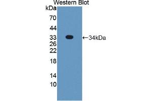Detection of Recombinant STX2, Human using Polyclonal Antibody to Syntaxin 2 (STX2) (STX2 antibody  (AA 8-262))