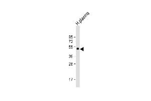 Anti-PROC Antibody at 1:1000 dilution + H. (PROC antibody)