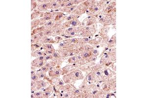 Immunohistochemical analysis of paraffin-embedded H. (MATN2 antibody  (AA 732-760))