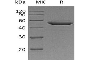 SERPINE2 Protein (His tag)