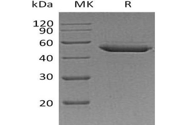 SERPINE2 Protein (His tag)