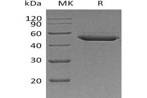 Western Blotting (WB) image for serpin Peptidase Inhibitor, Clade E (Nexin, Plasminogen Activator Inhibitor Type 1), Member 2 (SERPINE2) protein (His tag) (ABIN7320831) (SERPINE2 Protein (His tag))