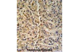 Immunohistochemistry (IHC) image for anti-Glucosamine (N-Acetyl)-6-Sulfatase (GNS) antibody (ABIN3002692) (GNS antibody)