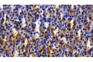 Immunohistochemistry (IHC) image for anti-Nuclear Factor of kappa Light Polypeptide Gene Enhancer in B-Cells Inhibitor, alpha (NFKBIA) (AA 74-247) antibody (ABIN7434194)