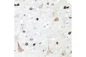 Immunohistochemistry of paraffin-embedded rat brain using IGFBP5 antibody. (IGFBP5 antibody)