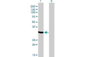 Western Blot analysis of ZNF215 expression in transfected 293T cell line by ZNF215 monoclonal antibody (M01), clone 2C11.