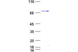 Validation with Western Blot (BTK Protein (His tag))