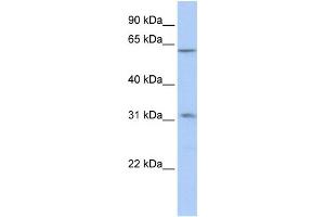 WB Suggested Anti-ZNF677 Antibody Titration:  0. (ZNF677 antibody  (C-Term))