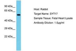 Image no. 1 for anti-Synaptotagmin XVII (SYT17) (AA 234-283) antibody (ABIN6750614) (SYT17 antibody  (AA 234-283))