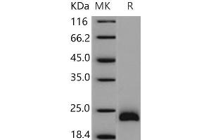 Western Blotting (WB) image for Endothelial Cell-Specific Molecule 1 (ESM1) protein (His tag) (ABIN7195501) (ESM1 Protein (His tag))