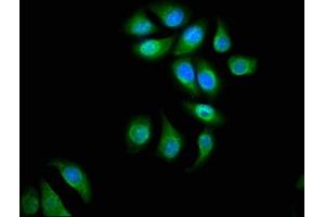 Immunofluorescence staining of A549 cells with ABIN7143827 at 1:66, counter-stained with DAPI. (alpha Actinin 4 antibody  (AA 160-440))