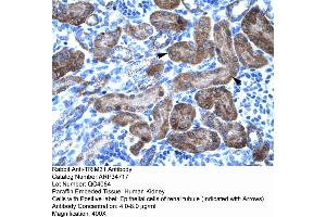 Human kidney (TRIM31 antibody  (N-Term))