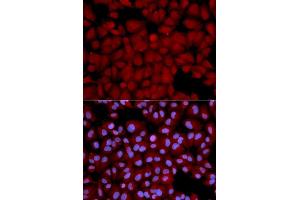 Immunofluorescence analysis of U2OS cells using PPP1CB antibody (ABIN5970446).