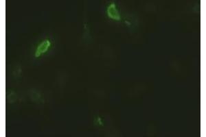 Anti-EpCAM mouse monoclonal antibody (ABIN2452362) immunofluorescent staining of HeLa cells transiently transfected by pCMV6-ENTRY EpCAM (RC201989) (EpCAM antibody  (AA 24-265))