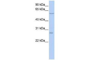 WB Suggested Anti-NETO2 Antibody Titration:  0. (NETO2 antibody  (N-Term))