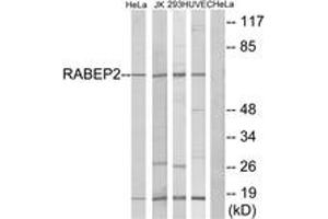 Western blot analysis of extracts from HeLa/Jurkat/293/HuvEc cells, using RABEP2 Antibody.