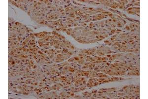 Immunohistochemistry (IHC) image for anti-Succinate Dehydrogenase Complex, Subunit B, Iron Sulfur (Ip) (SDHB) antibody (ABIN7127803)