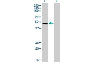 Western Blot analysis of VRK1 expression in transfected 293T cell line by VRK1 monoclonal antibody (M02), clone 4F9. (VRK1 antibody  (AA 287-396))