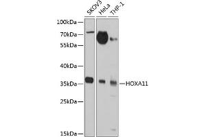 Western blot analysis of extracts of various cell lines, using HOX antibody (ABIN3017106, ABIN3017107, ABIN1680330 and ABIN6219956) at 1:1000 dilution. (Homeobox A11 antibody  (AA 1-180))