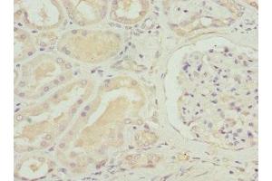 Immunohistochemistry of paraffin-embedded human kidney tissue using ABIN7170087 at dilution of 1:100 (SLC12A6 antibody  (AA 60-190))