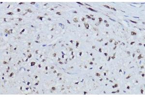 Immunohistochemistry of paraffin-embedded Human uterus using ESRRA Polyclonal Antibody at dilution of 1:200 (40x lens). (ESRRA antibody)